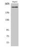 Kinase Insert Domain Receptor antibody, STJ93089, St John
