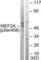 Myocyte Enhancer Factor 2A antibody, LS-C199245, Lifespan Biosciences, Western Blot image 