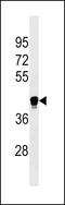 Leukocyte Immunoglobulin Like Receptor A6 antibody, 60-341, ProSci, Western Blot image 