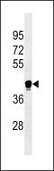 Leukocyte immunoglobulin-like receptor subfamily A member 6 antibody, 60-341, ProSci, Western Blot image 