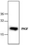 Placental Growth Factor antibody, GTX59639, GeneTex, Western Blot image 