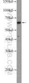 Thymocyte Expressed, Positive Selection Associated 1 antibody, 25975-1-AP, Proteintech Group, Western Blot image 