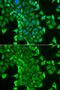 Cysteinyl-TRNA Synthetase antibody, GTX32489, GeneTex, Immunofluorescence image 