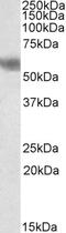 Dual Specificity Phosphatase 8 antibody, 45-507, ProSci, Western Blot image 