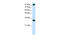 CCCTC-Binding Factor antibody, 31-172, ProSci, Western Blot image 