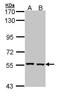 Catalase antibody, PA5-29650, Invitrogen Antibodies, Western Blot image 