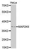 Mitogen-Activated Protein Kinase Kinase 6 antibody, STJ24469, St John