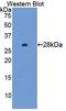 ITPR Interacting Domain Containing 2 antibody, MBS2026925, MyBioSource, Western Blot image 