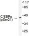 CCAAT Enhancer Binding Protein Alpha antibody, LS-C192177, Lifespan Biosciences, Western Blot image 