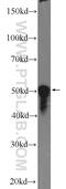 THAP Domain Containing 11 antibody, 23030-1-AP, Proteintech Group, Western Blot image 