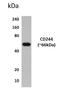 Natural killer cell receptor 2B4 antibody, GTX52521, GeneTex, Western Blot image 