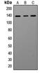Adenosine Deaminase RNA Specific antibody, MBS827156, MyBioSource, Western Blot image 