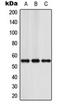 Iroquois-class homeodomain protein IRX-3 antibody, orb101413, Biorbyt, Western Blot image 