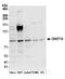CCR4-NOT Transcription Complex Subunit 10 antibody, A304-899A, Bethyl Labs, Western Blot image 