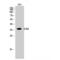 DNA Fragmentation Factor Subunit Alpha antibody, LS-C384058, Lifespan Biosciences, Western Blot image 