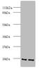 ADP Ribosylation Factor 4 antibody, A52593-100, Epigentek, Western Blot image 