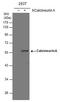 Protein Phosphatase 3 Catalytic Subunit Alpha antibody, PA5-29255, Invitrogen Antibodies, Western Blot image 