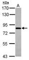 Component Of Oligomeric Golgi Complex 8 antibody, GTX110375, GeneTex, Western Blot image 