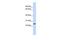 Proline Rich And Gla Domain 1 antibody, GTX46740, GeneTex, Western Blot image 