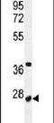 Ribosomal RNA Processing 36 antibody, PA5-24273, Invitrogen Antibodies, Western Blot image 