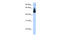 SS-A antibody, 28-827, ProSci, Western Blot image 