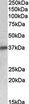 Sarcoglycan Delta antibody, orb125144, Biorbyt, Western Blot image 
