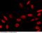 PCNA antibody, 101118-T46, Sino Biological, Immunohistochemistry paraffin image 