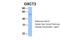 3-Oxoacid CoA-Transferase 2 antibody, 30-466, ProSci, Western Blot image 