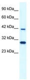 SEC12 antibody, TA334757, Origene, Western Blot image 