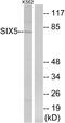 SIX Homeobox 5 antibody, GTX87610, GeneTex, Western Blot image 