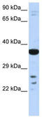 Visual system homeobox 1 antibody, TA339471, Origene, Western Blot image 