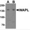 WAPL Cohesin Release Factor antibody, MBS153367, MyBioSource, Western Blot image 