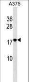 Ras Homolog Family Member F, Filopodia Associated antibody, LS-C162596, Lifespan Biosciences, Western Blot image 