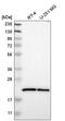 SRI antibody, HPA019004, Atlas Antibodies, Western Blot image 