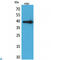 Heat Shock Protein Family A (Hsp70) Member 6 antibody, LS-C813432, Lifespan Biosciences, Western Blot image 