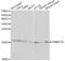 Translocase Of Inner Mitochondrial Membrane 17A antibody, A13578, ABclonal Technology, Western Blot image 