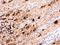 Enterovirus antibody, GTX132339, GeneTex, Immunohistochemistry paraffin image 