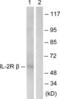 Interleukin 2 Receptor Subunit Beta antibody, LS-C117960, Lifespan Biosciences, Western Blot image 