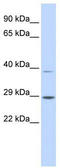 Pseudoautosomal homeobox-containing osteogenic protein antibody, TA334167, Origene, Western Blot image 