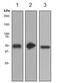 Glycoprotein A33 antibody, ab108938, Abcam, Western Blot image 