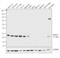 Ubiquitin C-Terminal Hydrolase L1 antibody, MA1-90008, Invitrogen Antibodies, Western Blot image 