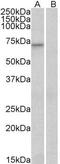 Forkhead Box O3 antibody, GTX17026, GeneTex, Western Blot image 