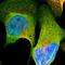 Nerve Growth Factor Receptor antibody, HPA004765, Atlas Antibodies, Immunofluorescence image 