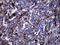 Cathepsin L antibody, LS-C792017, Lifespan Biosciences, Immunohistochemistry paraffin image 