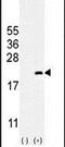 Cyclin Dependent Kinase Inhibitor 2C antibody, PA5-24435, Invitrogen Antibodies, Western Blot image 
