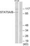 Signal Transducer And Activator Of Transcription 5A antibody, LS-C119600, Lifespan Biosciences, Western Blot image 