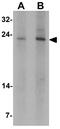 Tumor Protein, Translationally-Controlled 1 antibody, GTX31519, GeneTex, Western Blot image 