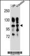 Integrin Subunit Alpha 5 antibody, 56-279, ProSci, Western Blot image 