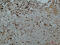 Galectin 3 antibody, GTX34031, GeneTex, Immunohistochemistry paraffin image 