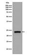 RAB5A, Member RAS Oncogene Family antibody, M01891, Boster Biological Technology, Western Blot image 